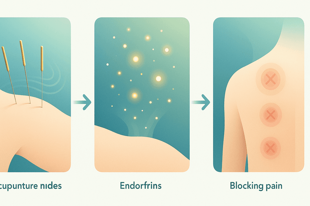 Immediate Pain Relief Through Targeted Needle Placement